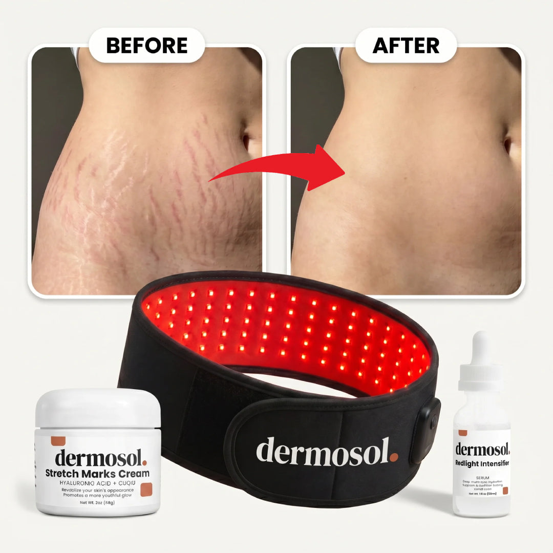 Postpartum stomach before and after 16 weeks of the supervised protocol