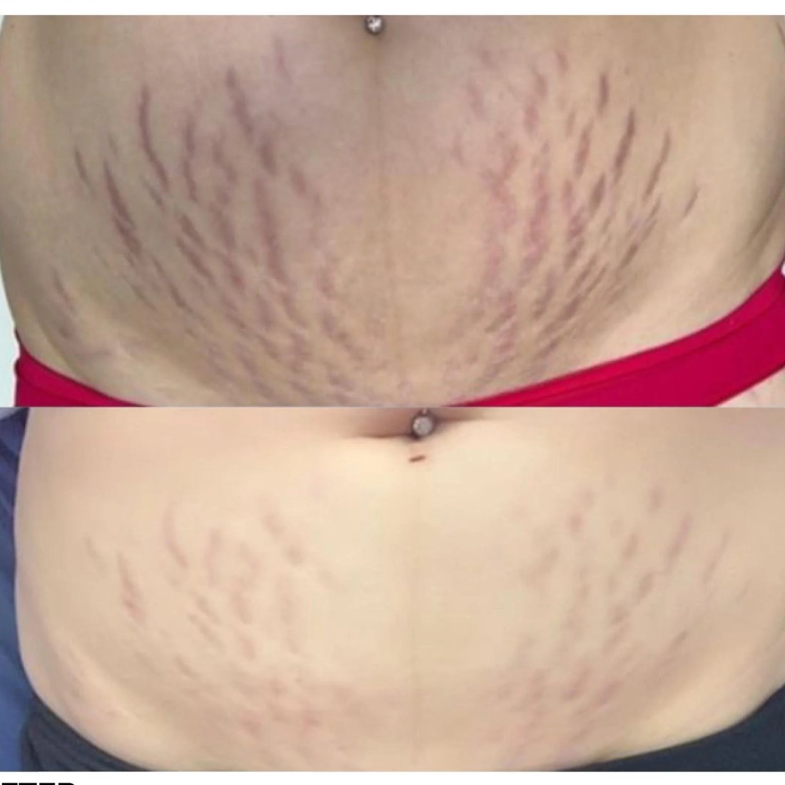 Member before and after photo