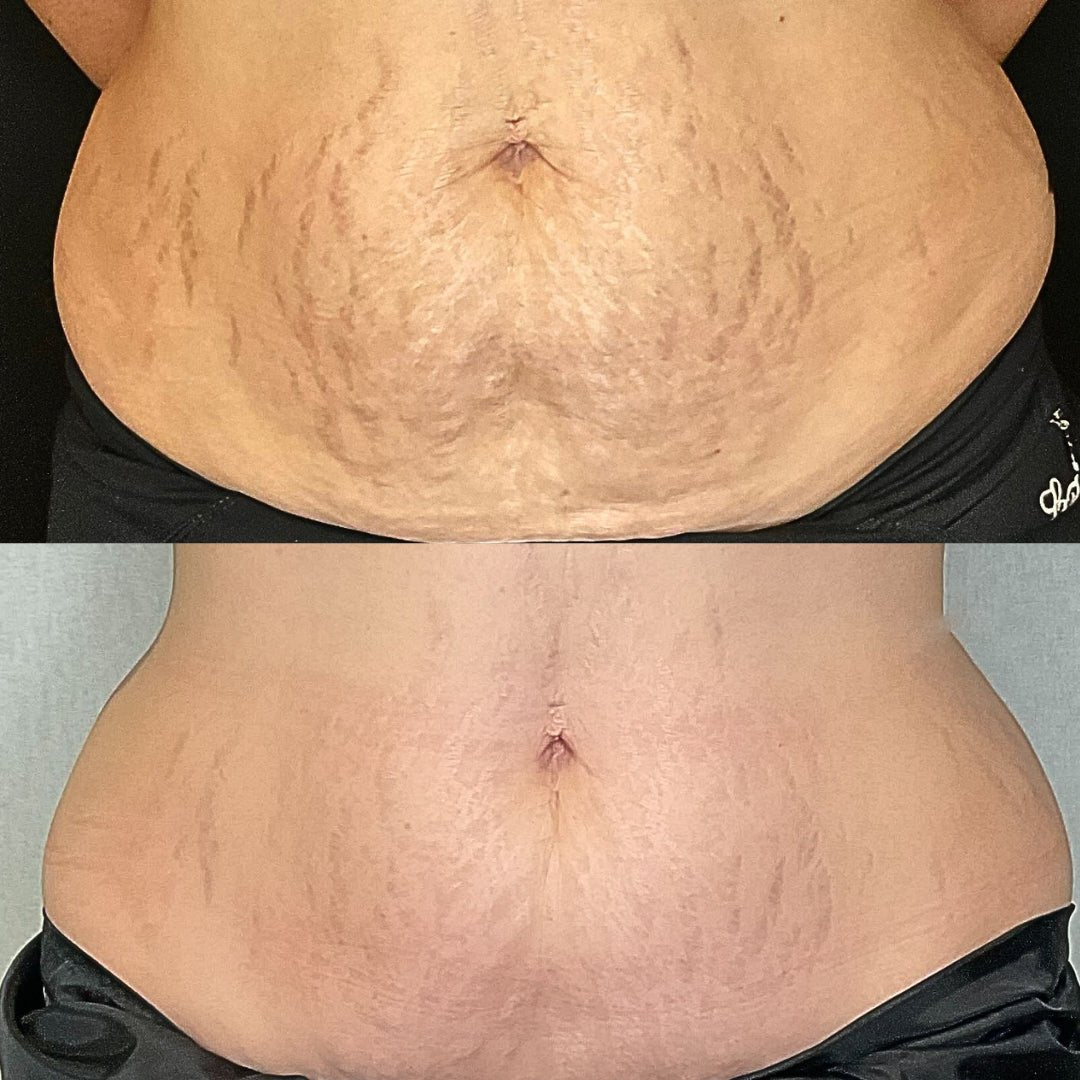 Member before and after photo
