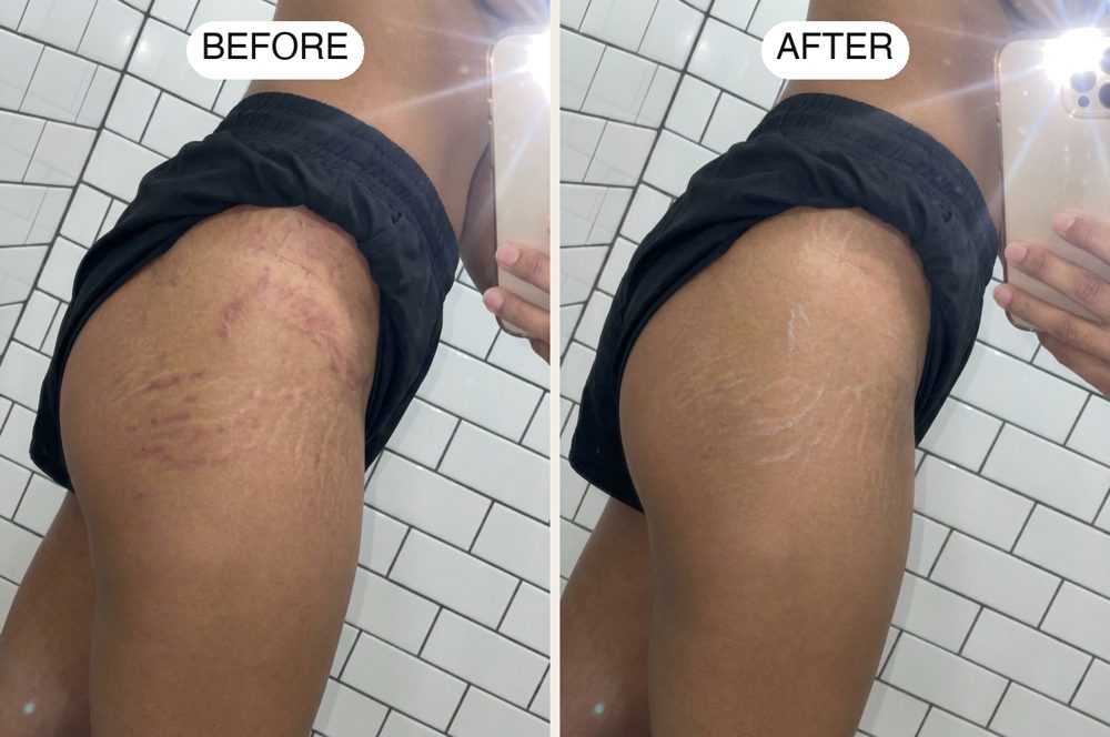 Member before and after photo