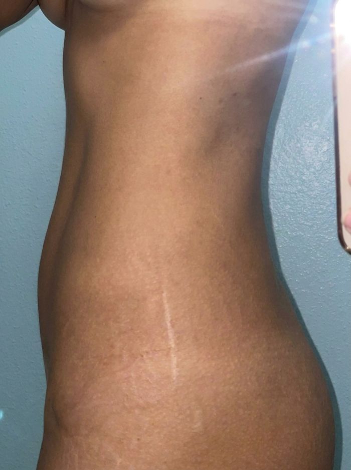Member progress photo