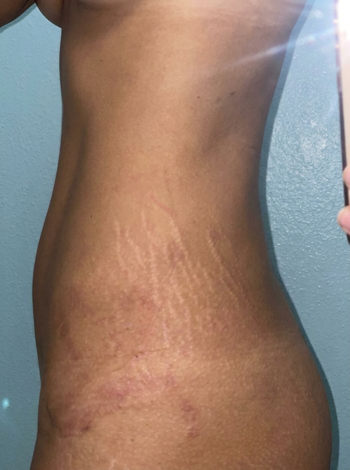 Member progress photo