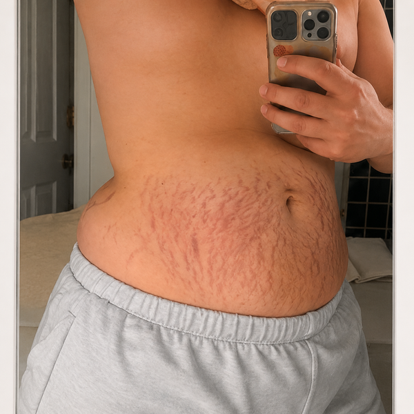 Skin Assessment