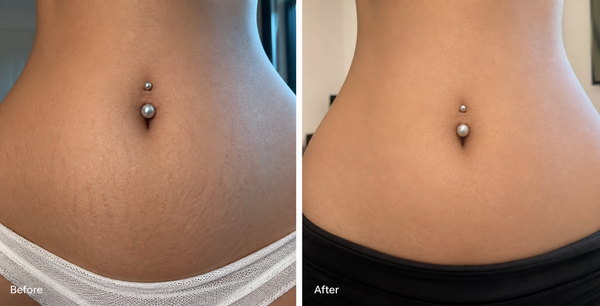 Before and After