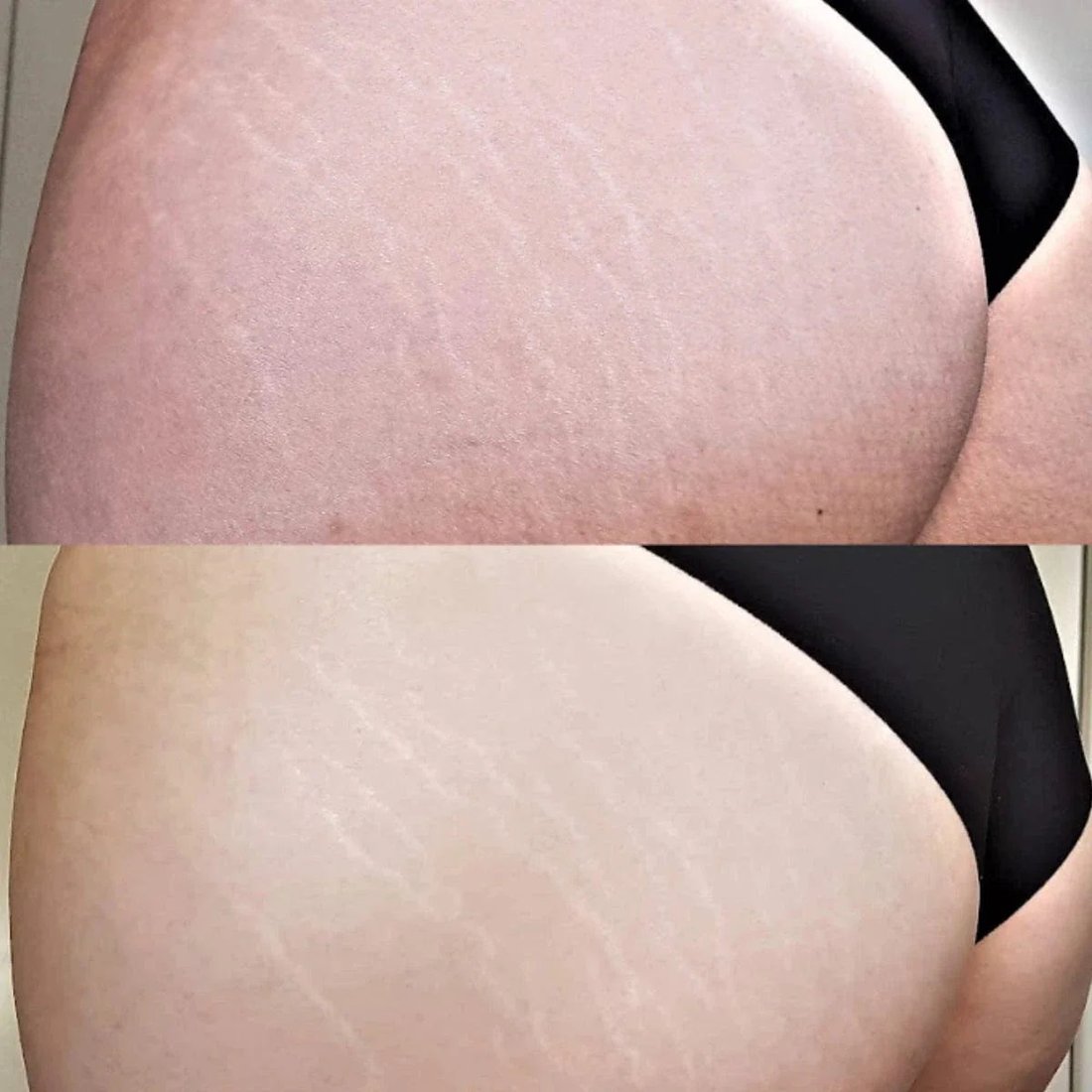 Member before and after photo